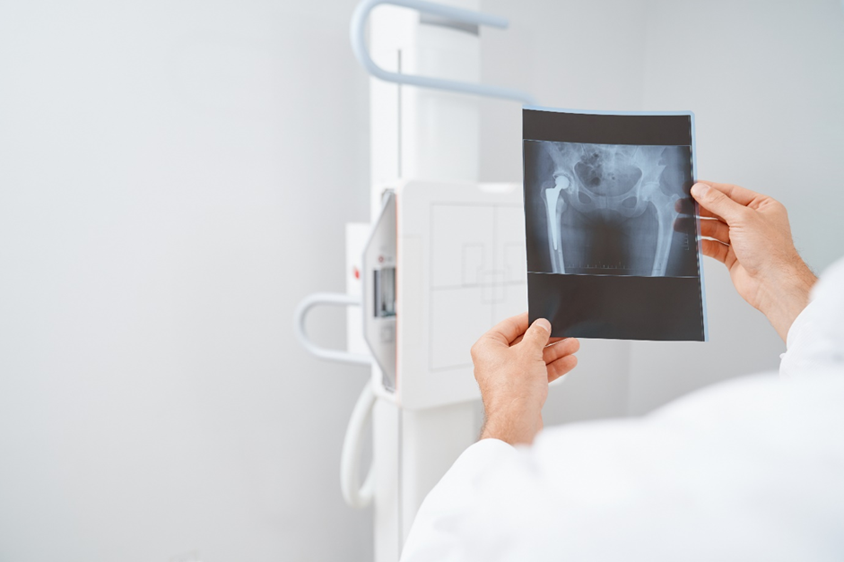 Why X-rays Are a Vital Diagnostic Tool in Medicine